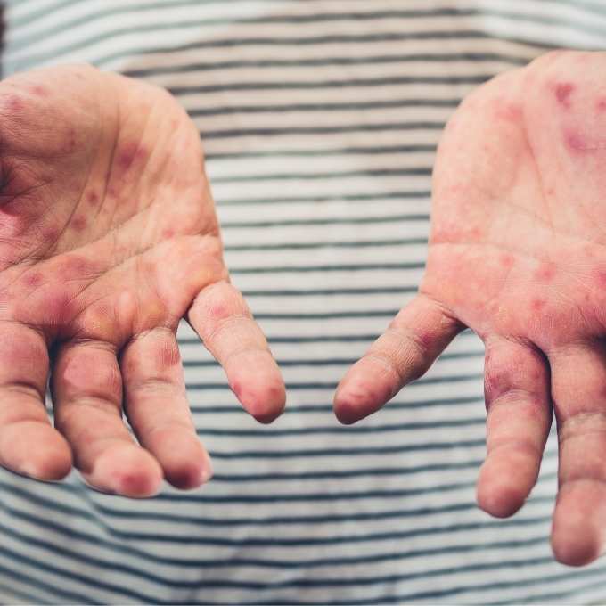 Minnesota Biohazard & Trauma Cleanup Services